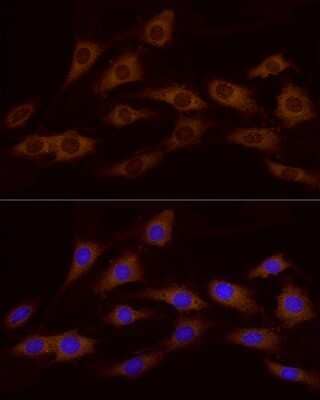 Immunocytochemistry/Immunofluorescence: ATP6V0A1 Antibody [NBP2-92219] - Immunofluorescence analysis of C6 cells using ATP6V0A1 antibody (NBP2-92219) at dilution of 1:100. Blue: DAPI for nuclear staining.